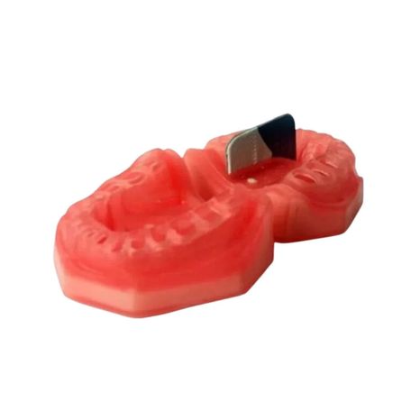 Refil Top Endodontia AC109 - Pronew