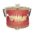 Manequim Top Exodontia PD113 - Pronew