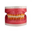 Refil Cirurgia com Dentes de Perio AC025 - Pronew